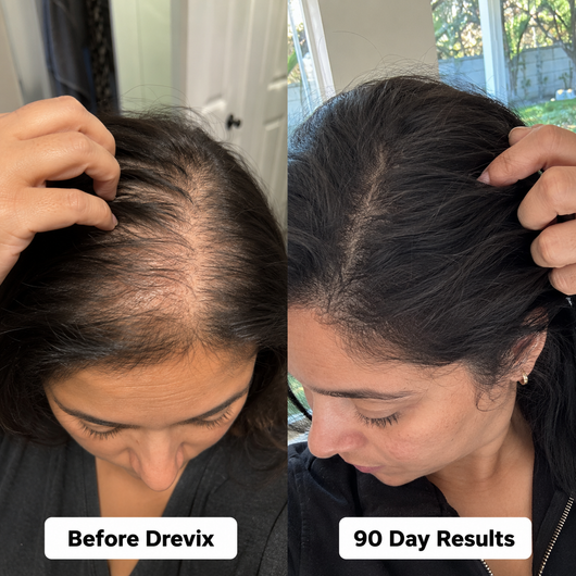 Drevix™ Pumpkin Seed Oil & Saw Palmetto Softgels